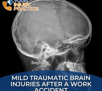 Mild Traumatic Brain Injuries after a work accident 360x320