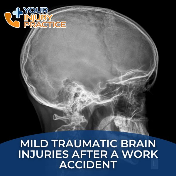 Mild Traumatic Brain Injuries after a work accident